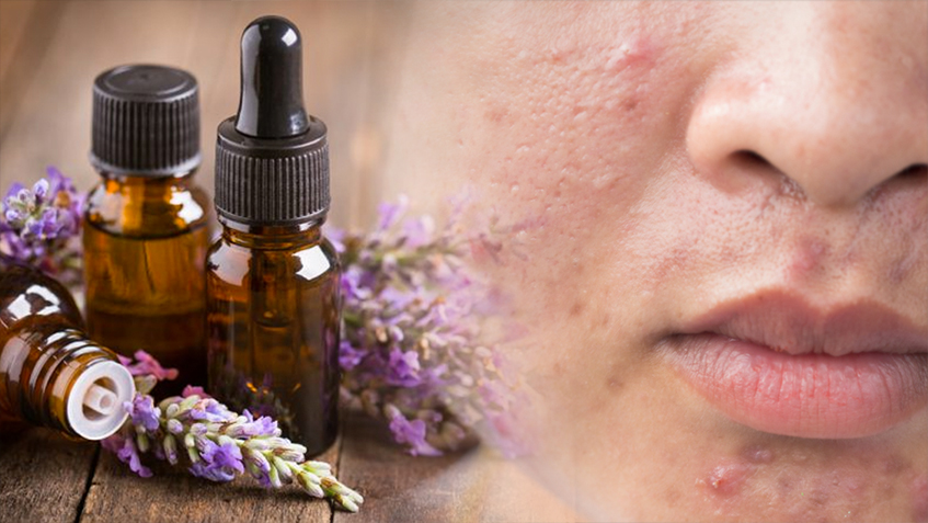 The Uses Of Lavender Essential Oils: From Oily Skin To Toothaches 